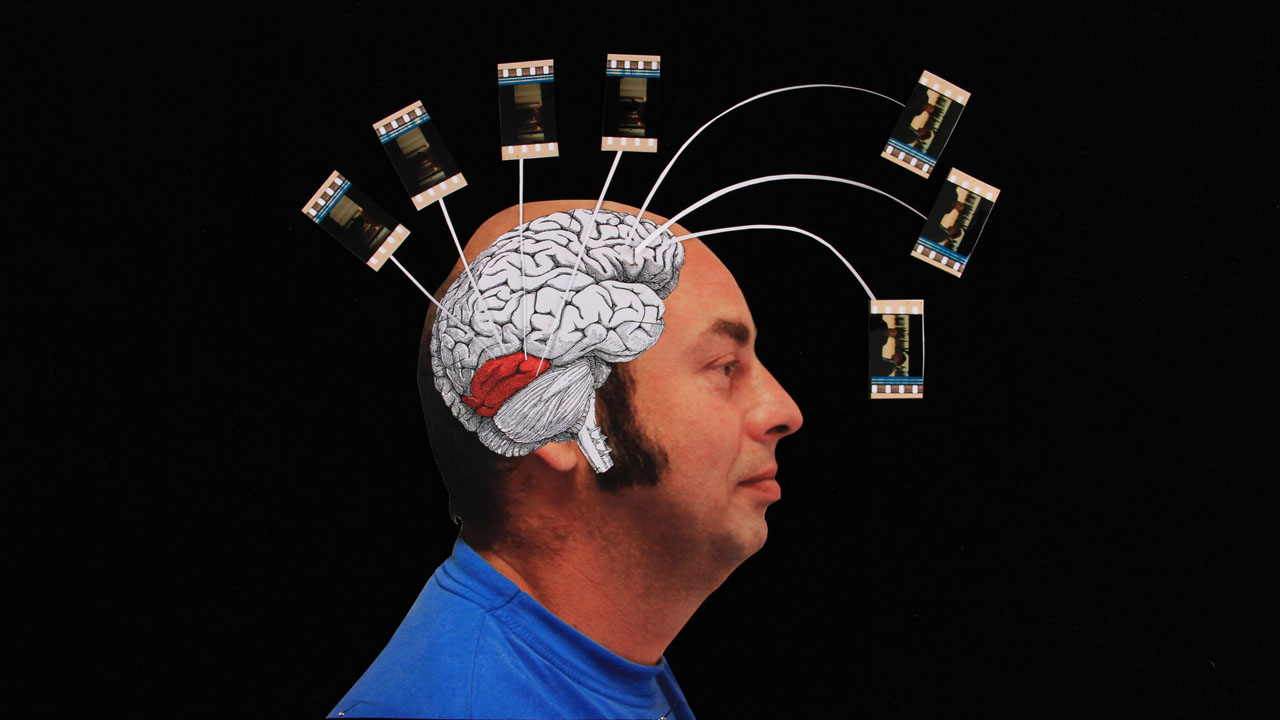 marie visuel syndrome.jpg